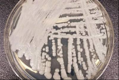 Pernambuco confirma 3ª morte de paciente com o superfungo Candida auris