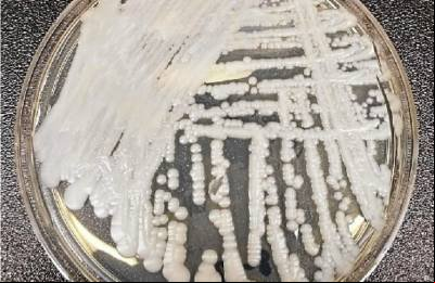O que é Candida auris, fungo mortal que fechou hospital em Pernambuco